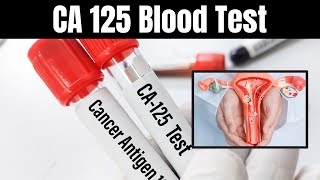 CA 125 Blood Test Explained Uses Procedures and What It Means for You [upl. by Novy]