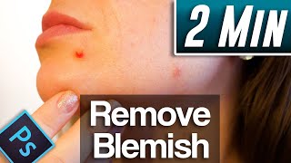 Photoshop 2021  How to Remove Blemishes and Acne Fast Tutorial [upl. by Ormond]