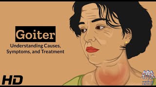 Thyroid Troubles Navigating Goiter  Causes Symptoms and Treatment Explained [upl. by Arakal]