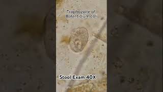 Balantidium coli trophozoite  Protozoa  stool examination 40X  shorts [upl. by Doomham]