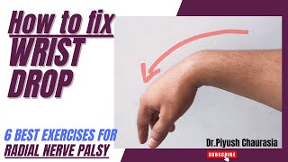 Physiotherapy Treatment Of Wrist DropEffective Exercises For Radial Nerve Palsy [upl. by Nylrad]