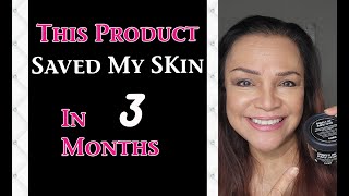 Lost the Glow of Your Skin Try this exfoliant in 3 months [upl. by Nuhsed915]