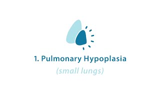 CDH Part 2 CDH Pulmonary Hypoplasia [upl. by Rihsab]