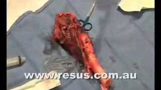 Surgical Airway on resuscomau [upl. by Anyad]