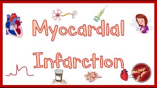 Myocardial InfarctionHeart Attack Causes Pathogenesis Signs amp Symptoms Diagnosis amp Treatment [upl. by Epperson]