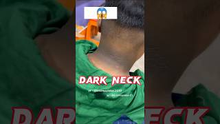 Dark Neck Home Remedy  Get Rid of Dark Neck  Dark Hands  Dark Elbow  Dark Feet  Remove Body Tan [upl. by Meill]