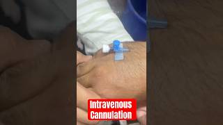 ivcannulation intravenous intravenouscannulation subscribe SMpharmacy follow rap [upl. by Kaazi]