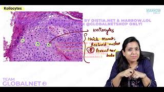 FEMALE GENITAL TRACT  PART 1 By Dr Illa jain khandelwal Pathology by Marrow Video Lecture [upl. by Macilroy]