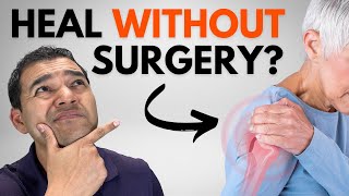 Can a Shoulder Labrum Tear ACTUALLY Heal Naturally Without Surgery [upl. by Nunes222]