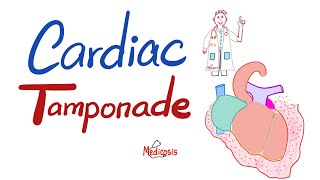 Echocardiogram of a Patient With Cardiac Tamponade [upl. by Durnan]