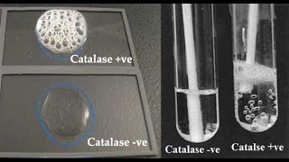 Microbiology catalase test [upl. by Indyc]