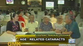 AgeRelated Cataracts [upl. by Elora5]