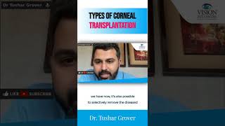 Types of Corneal Transplantation  Dr Tushar Grover [upl. by Oflodor664]