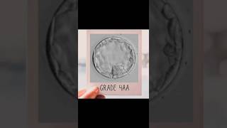 Good Quality Day 5 Blastocyst Embryo 👼🏻blastocyst [upl. by Islek498]