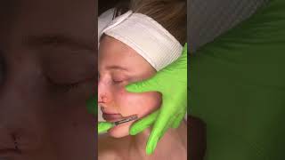 ASMR Mesmerizing Dermaplaning Treatment [upl. by Anyg279]