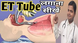 ET Tube Intubation How To Insert ET Tube drsubhashkumar [upl. by Ecnerrot109]