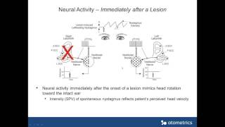 Otometrics webinar  Vestibular Compensation [upl. by Luthanen]