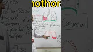 Hemothorax Pathalogy topnewstoday anatomy topbeats endocrineglands love topbeat humanbody [upl. by Eclud]