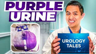 Urology Story Time  Purple Urine [upl. by Telrats]