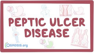 Peptic ulcer disease  causes symptoms diagnosis treatment pathology [upl. by Leighland956]