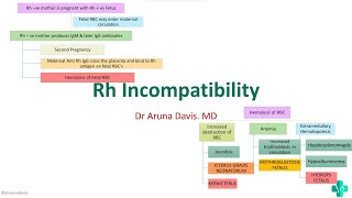 Rh Incompatibility HEMOLYTIC DISEASE OF NEWBORN Erythroblastosis Fetalis [upl. by Narag]