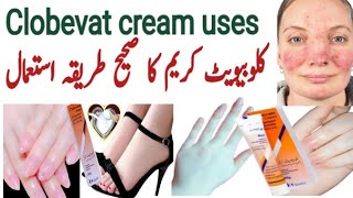 clobevate cream for hands and feet whitening  clobevate for skin whiteing  clobetasol  eczema [upl. by Roybn830]