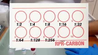 RPR TEST Procedimiento explicado para realizar el examen Incluye titulación [upl. by Neraj]