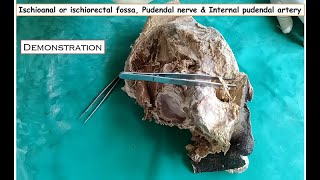 Ischioanal or Ischiorectal fossa Pudendal nerve amp Internal pudendal artery dissection Demonstration [upl. by Anyala]