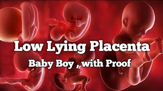 Low Lying Placenta💖Placenta position really predict the Baby Gender💖Baby Boy scan reports proof [upl. by Otrebor]