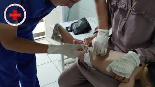 Intramuscular injection for baby buttock injection [upl. by Eirallam]