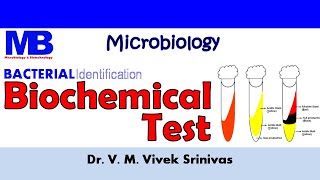 BIOCHEMICAL TEST  Bacterial Identification Technique  Microbiology  Vivek Srinivas Bacteriology [upl. by Tailor]