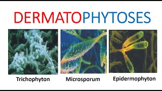 Mycoses Dermatophytoses Teignes champignon des ongles du pied cuir chevelu quotFacteurs favorisantsquot [upl. by Aihtela]