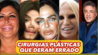 CIRURGIAS PLÁSTICAS QUE NÃO DERAM CERTOcirurgiaplastica bizarras famosos [upl. by Neggem]