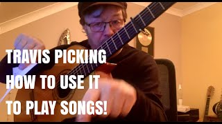 TRAVIS PICKING  HOW TO USE IT TO PLAY SONGS [upl. by Hermine]