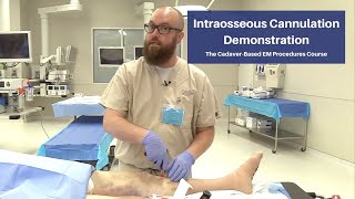 Intraosseous Cannulation Demonstration  The CadaverBased EM Procedures SelfStudy Course [upl. by Suoivatram]