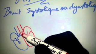 Astuce  bruit systolique ou diastolique   Dr Astuce [upl. by Parhe]