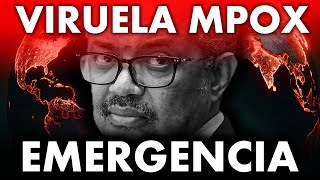 Urgente 💥 VIRUELA DEL MONO será EMERGENCIA SANITARIA INTERNACIONAL [upl. by Saphra]