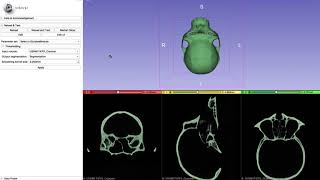 Segmenting Endocranial cavity and making an endocast [upl. by Adyahs757]