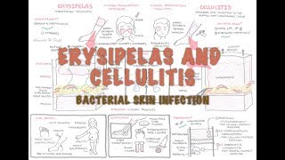 Bacterial Skin Infection  Cellulitis and Erysipelas Clinical Presentation Pathology Treatment [upl. by Enyad550]