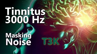 Tinnitus T3K 3000 Hz Noise Masking Might Relieve Your Ringing [upl. by Brenden]