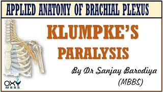 Klumpkes Paralysis [upl. by Niven]