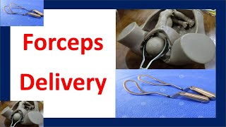 Forceps Delivery  Forceps Assisted Delivery  Delivery with Forceps [upl. by Pavier]