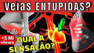 VEIA ENTUPIDA QUAL A SENSAÇÃO Como combater a falta de circulação nas pernas pés e coração [upl. by O'Neil]