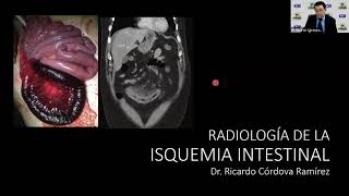 1  8 Radiología de la Isquemia Intestinal  Dr Cordova [upl. by Najtsirk810]