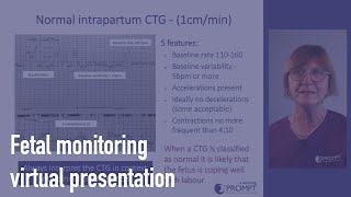 Fetal monitoring [upl. by Jacey]