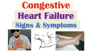 Congestive Heart Failure Signs amp Symptoms amp Why They Occur [upl. by Adigirb]