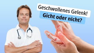 Geschwollenes Gelenk Gicht oder nicht [upl. by Finzer]