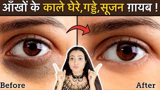 In 7 Days 💕 Remove DARK CIRCLES काले घेरे PUFFY EYES गड्ढे SUNKEN EYES Naturally  100 Results [upl. by Nonez92]