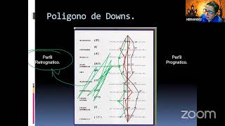 Analisis cefalometrico Downs [upl. by Giles]