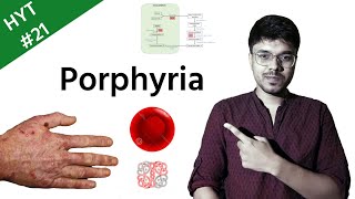 Porphyria  Biochemistry  HYT 21  NEETPG  INICET [upl. by Trainer225]